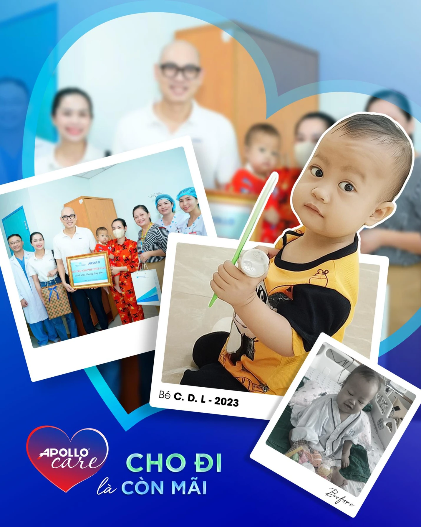 Bé Bé C.D.L. đã phục hồi và khỏe mạnh sau bốn tháng thực hiện ca phẫu thuật ghép gan